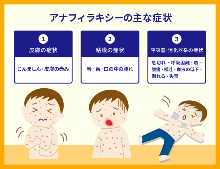 薬の副作用とは？対応方法や患者副作用報告制度について解説 - 大規模診療データベースサービス | MDV RWD insight